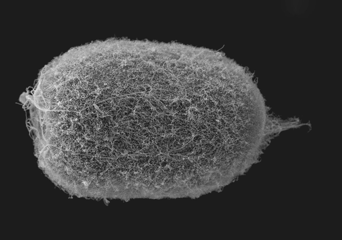 2016Wsbs's tweet photo. hairy #planula with apical organ and extra ordinary long cilia surrounding mouth from this September #BlackSea . Anthozoan planula ? any other precise taxonomical guesses are very welcome ! https://t.co/bWhhNLG39T