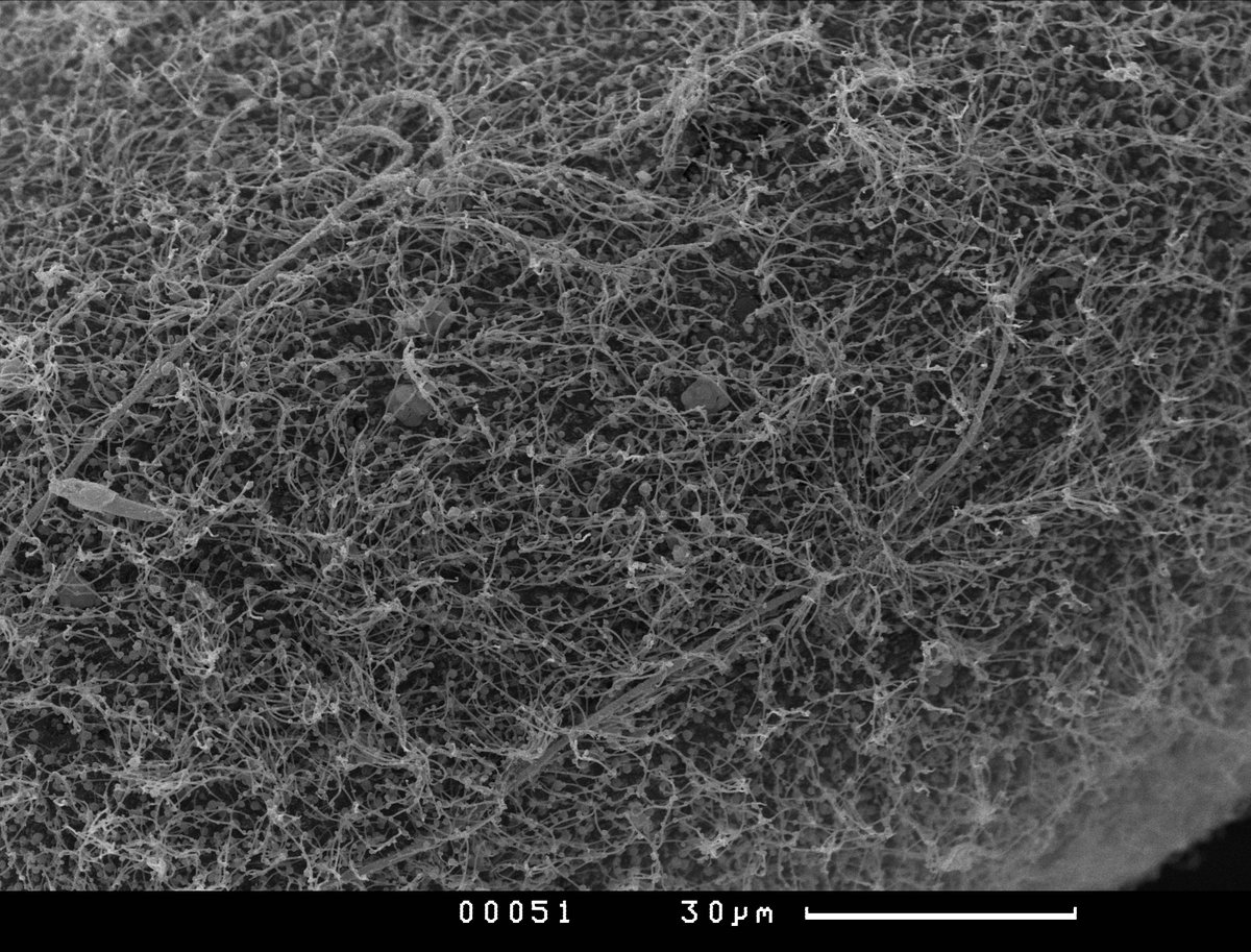 2016Wsbs's tweet photo. hairy #planula with apical organ and extra ordinary long cilia surrounding mouth from this September #BlackSea . Anthozoan planula ? any other precise taxonomical guesses are very welcome ! https://t.co/bWhhNLG39T