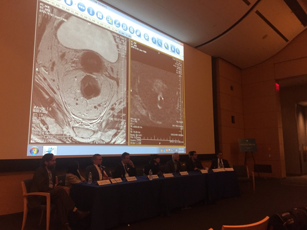 @prof_gina_brown & Dr Beets-Tan comment on potential local regrowth after TNT #tumordeposit #MSKCOL100CME
