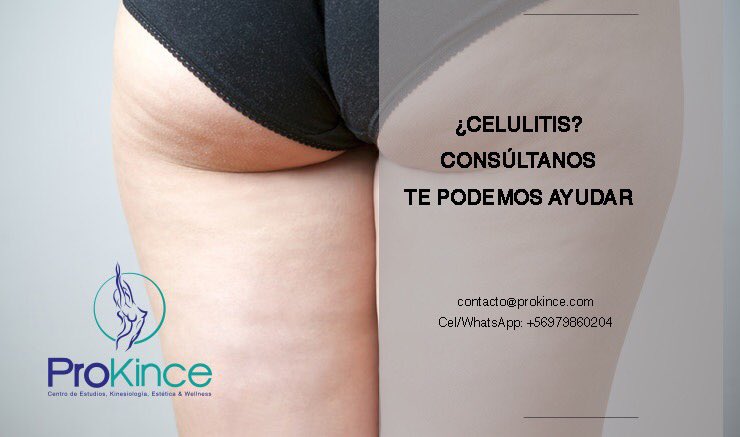 prokince tweet picture