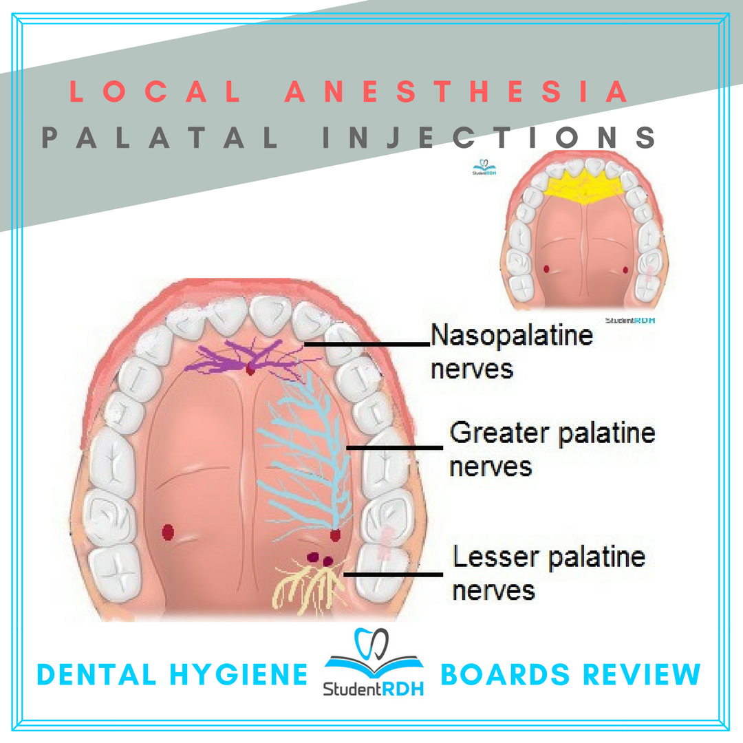 StudentRDH's tweet image. #SaturdayDefinitions #StudentRDH