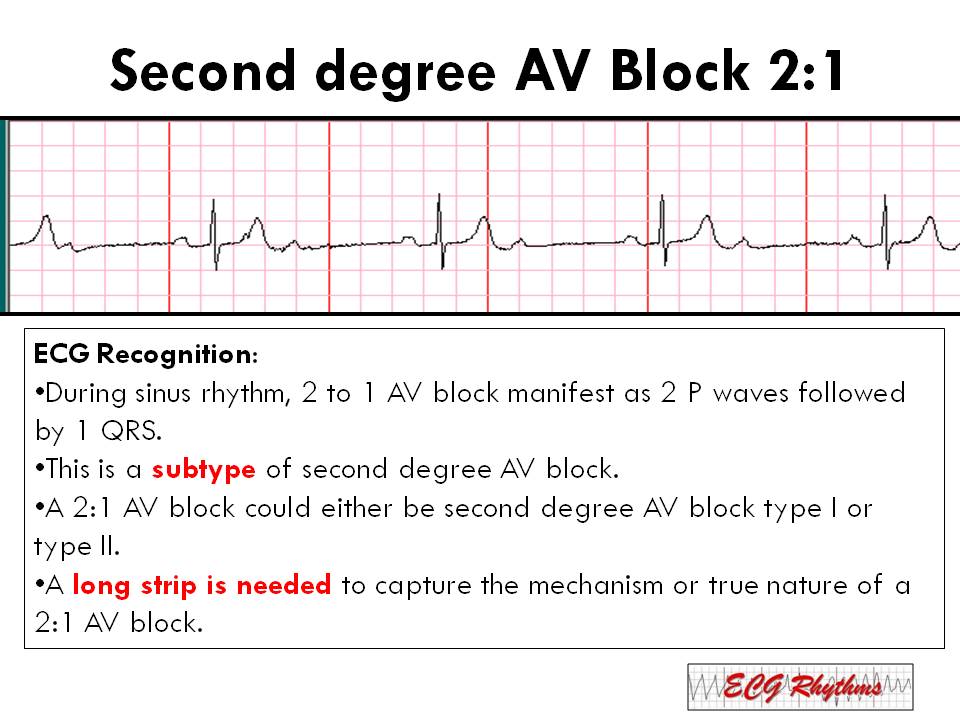 basic ekg ไทย 2021