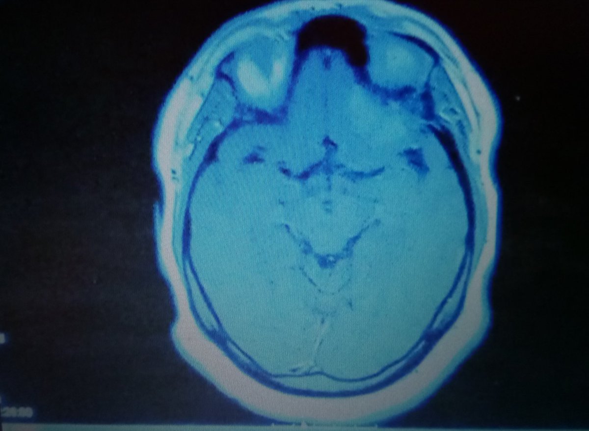 Sammy (Brain Tumour Warrior) tweet media