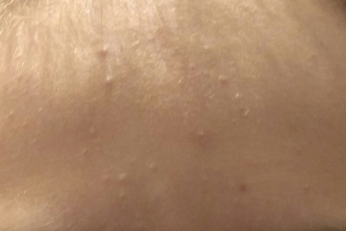 Co prosím pomáhá na takovou pleť? <a href="/anketycz/">ankety 🌻</a>