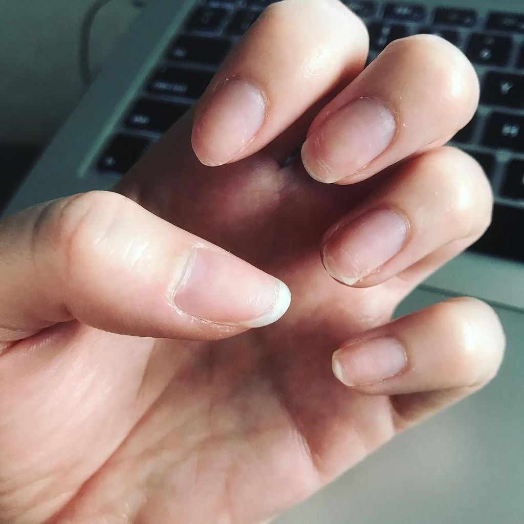 Kitta's tweet image. Current nail status: broken, bare and short. ☹️ #donotlike #ineedanailtech #firstworldnailproblems ift.tt/2jkGKRk