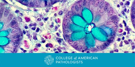 Pathologists's tweet photo. Elevating Pathology to an Art Form: 3 finalists from #cap17dc photo contest:  https://t.co/zHMtwvyH12. #pathart @SueEPig @ALBoothMD https://t.co/C5JezH7L2a