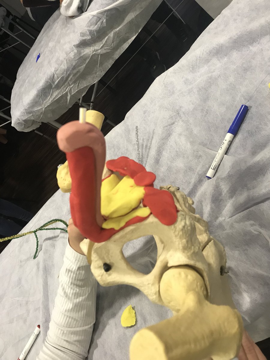 Fisioblanes's tweet photo. PERINÉ MASCULINO!!!! ABORDAJE MANUAL!!! QUE BIEN LO HE PASADO!!! Gracias amezola https://t.co/wJpCaAVPUM