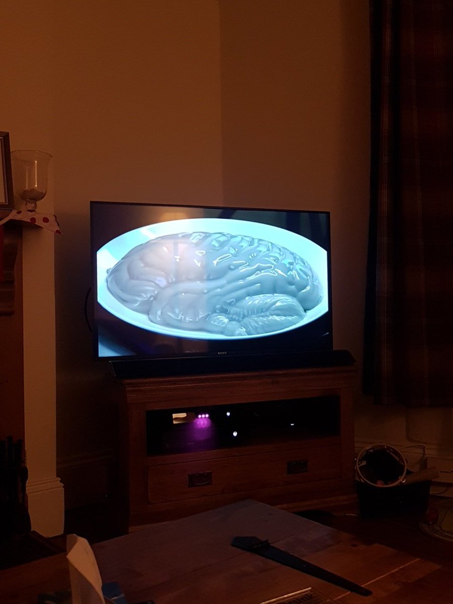 dr_rob69's tweet photo. Fascinating documentary on BBC #FootballandDementia
Where can a get a jelly mold like that though?! #pathfood #neuropath https://t.co/Wy1iRHS8JH