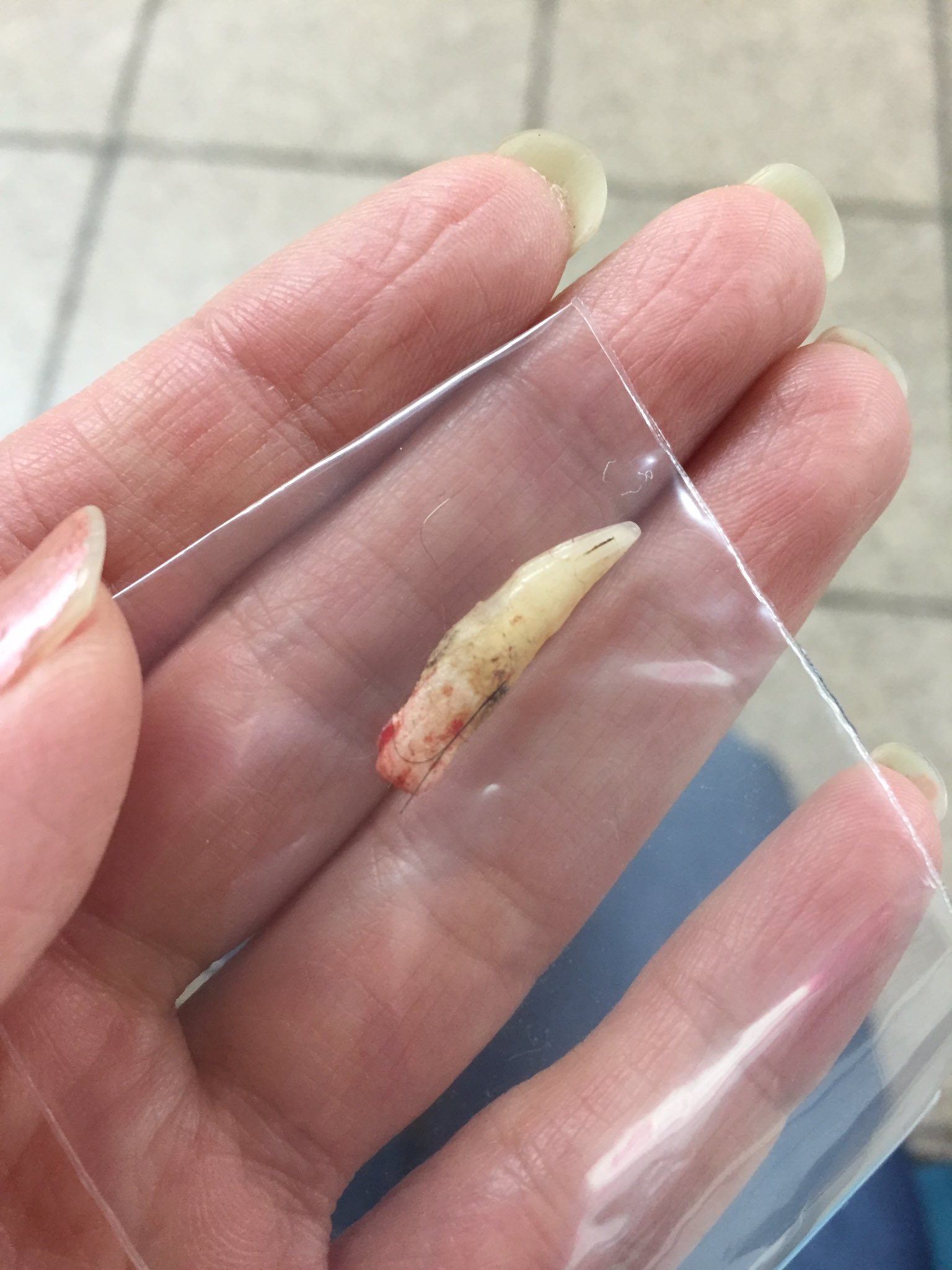 あまみや七音 声優 ナレーター ボイスドクター もみ次 殴られて犬歯が折れました 猫 １７歳 老化で無駄に吠え あまりにもうるさいので よく家族に怒られてます 今日は 痛かったね 病院で処置して貰いました 捨てるのはエゴ しかし