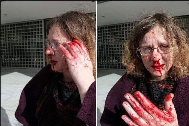 lvikint's tweet photo. ASÍ ha acabado una abogada que estaba en juicios contra Amanecer Dorado. Un nazi le ha agredido con total impunidad. El fascismo avanza si no se le combate. https://t.co/tGk6ja8ocR