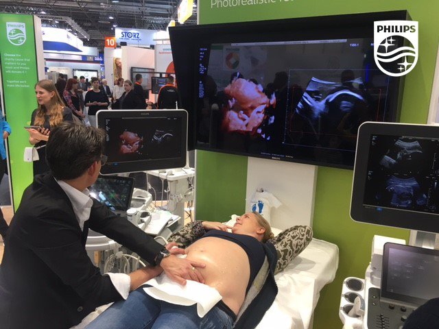 PhilipsLiveFrom's tweet image. Philips #TrueVue presentation with #Live Scanning: Now in hall 10, booth A22 at #MEDICA2017. Join us for a preview.