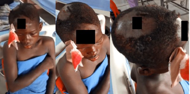 BlogjistNaija's tweet photo. [PHOTOS] Nigerian Woman Throws Her Housemaid Down From 2nd Floor Of Their House In Lagos https://t.co/jVlBRu8ZAi https://t.co/WEjSMizQkI
