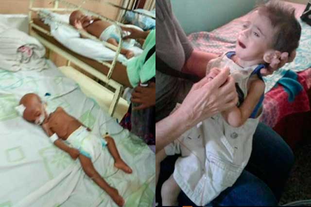NoticiasCaracol's tweet photo. “Muchas veces nos acostamos sin comer”: lanzan SOS por niños que mueren de desnutrición en Venezuela https://t.co/VvMhzEAuq6 https://t.co/nG6VCU0grN