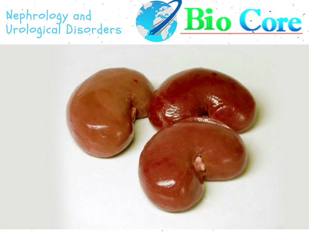 Biocore_Ijnu's tweet photo. We, at Biocore Group, are famous in providing quality peer review through our esteemed Editorial Board
#Biocore_Group
#Biocore_Open_Access_Journals
#IJNU
#Nephrology_Journal
https://t.co/M8aYbK1IAG https://t.co/q5cEP6vL6S