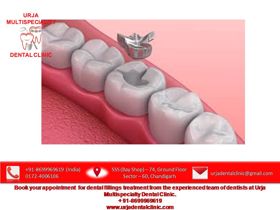 india_dental's tweet photo. #dentalfillings #temporaryfilling #temporarytoothfilling #toothcavityfilling #temporarydentalfilling 
+91-8699969619
https://t.co/nSLQGAGWQq https://t.co/HOAjZj4As8