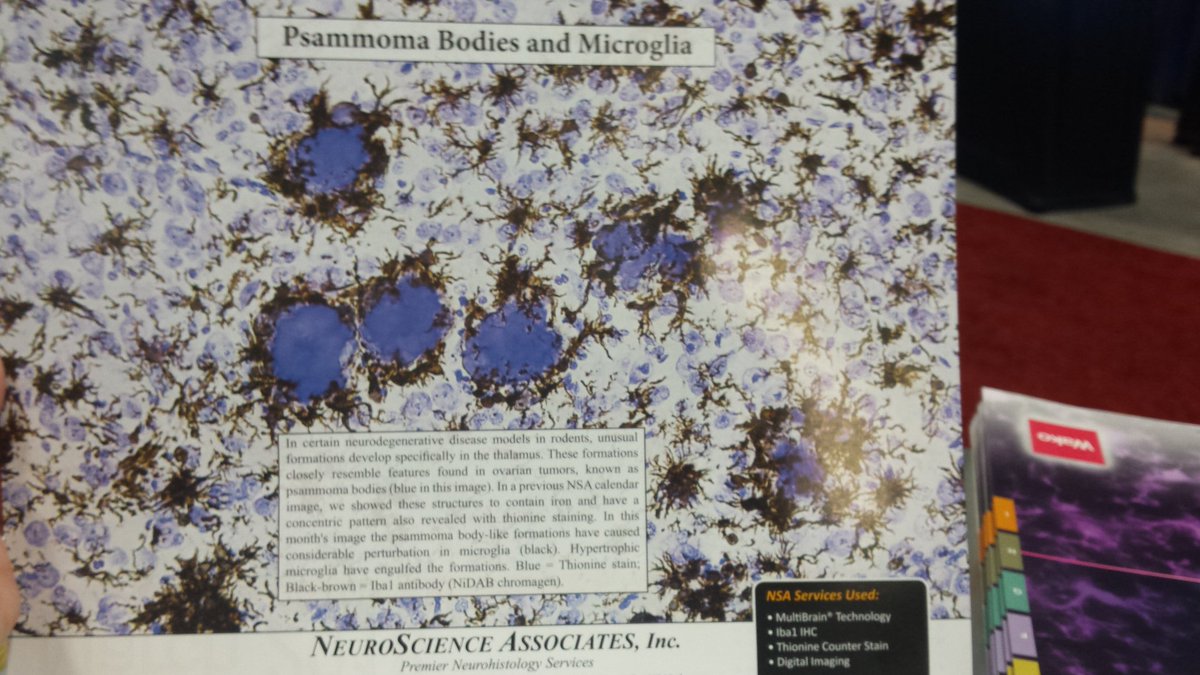 WakoChemicalsUS's tweet photo. SFN 17, booth 2138. Come by and see us. We are next to our friends at Neuroscience Associates. #microglia #Iba1 #Alzheimers https://t.co/M80SUOp04u