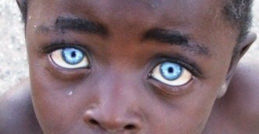 Kid That Has A Different Dna Cat Eyes Kid That Has A Different Dna Cat Eyes