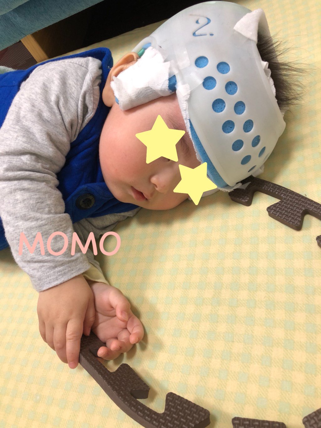 頭蓋変形 Twitter Search Twitter