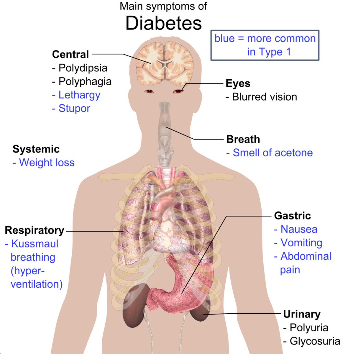 SEMDocs's tweet photo. #WorldDiabetesDay
#medbullets
#MedEd https://t.co/smeO5Ro8Ol