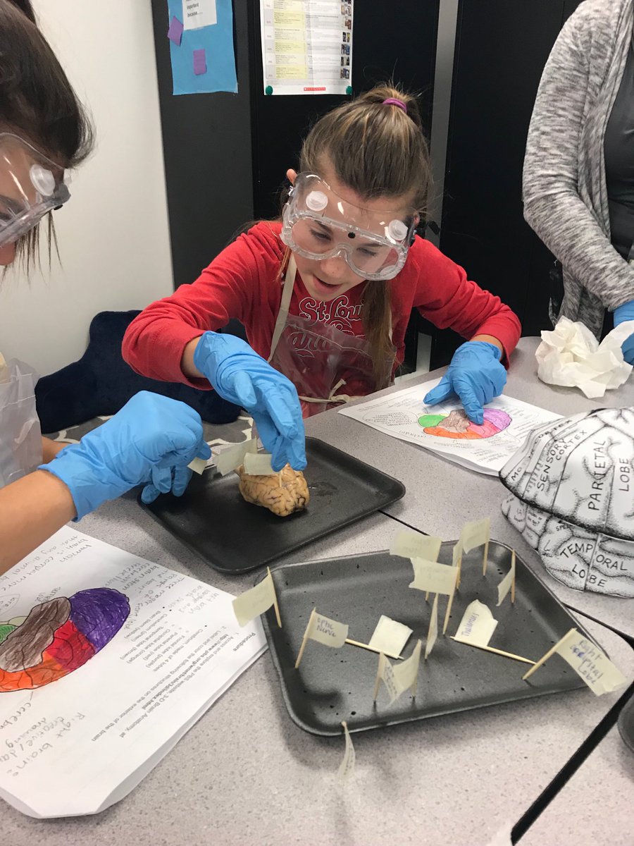 jesanderson33's tweet photo. It was a great day to be a Medical Detective! #WSDlearns #WBEdreamsbig #PLTW #sheepBRAINdissection @PLTW_MO https://t.co/hRiWmVOSXL
