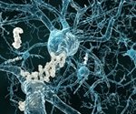 Journal_AJCPR's tweet photo. Scientists identify critical player in Alzheimer's disease pathogenesis #Pathogenesis #AlzherimersDisease #Alzheimer #PathologyNews #AcceptingArticles #SubmitManuscript #UpcomingIssue https://t.co/oM69Uug0mN