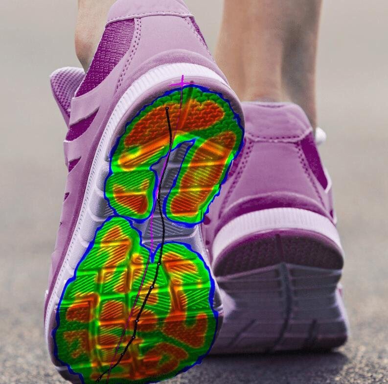 RSscanLab's tweet image. On route to @SCP_PodiatryUK #copc17 Footscan and Orthotics at the ready! 👞👟👡