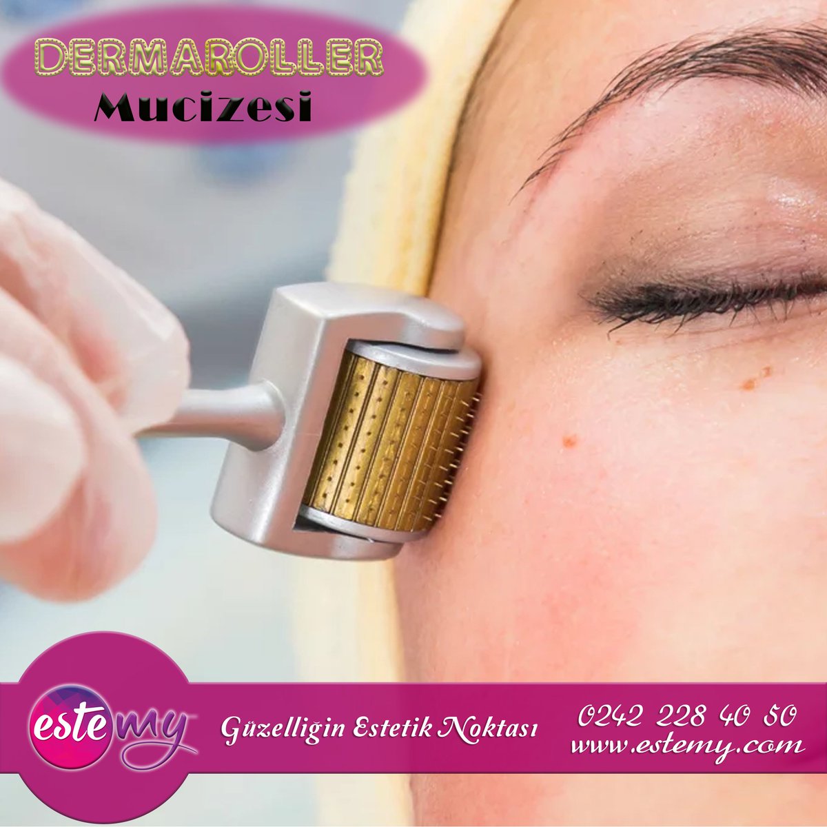 Dermaroller mucizesi ile tanışmaya hazır mısınız? Cildinizde istemediğiniz leke, akne ve skar izleri veya ince çizgilerle yaşamak zorunda değilsiniz!
estemy.com - Güzelliğin Estetik Noktası
#estemy #güzellik #dermaroller #epilasyon #bölgeselzayıflama #ciltbakımı