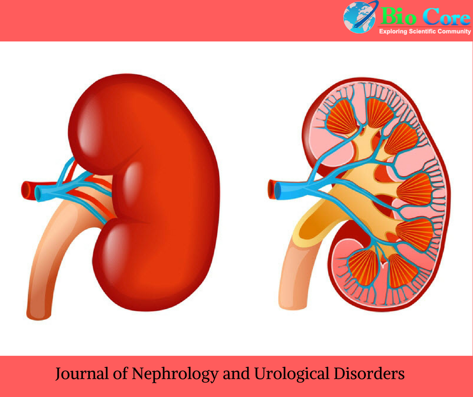 Biocore_Ijnu's tweet photo. We are a team of expert professionals, who have experience in handling blind peer review
#Biocore_Group
#Biocore_Open_Access_Journals
#IJNU
#Nephrology_Journal
https://t.co/M8aYbK1IAG https://t.co/u2L9lzyX8t