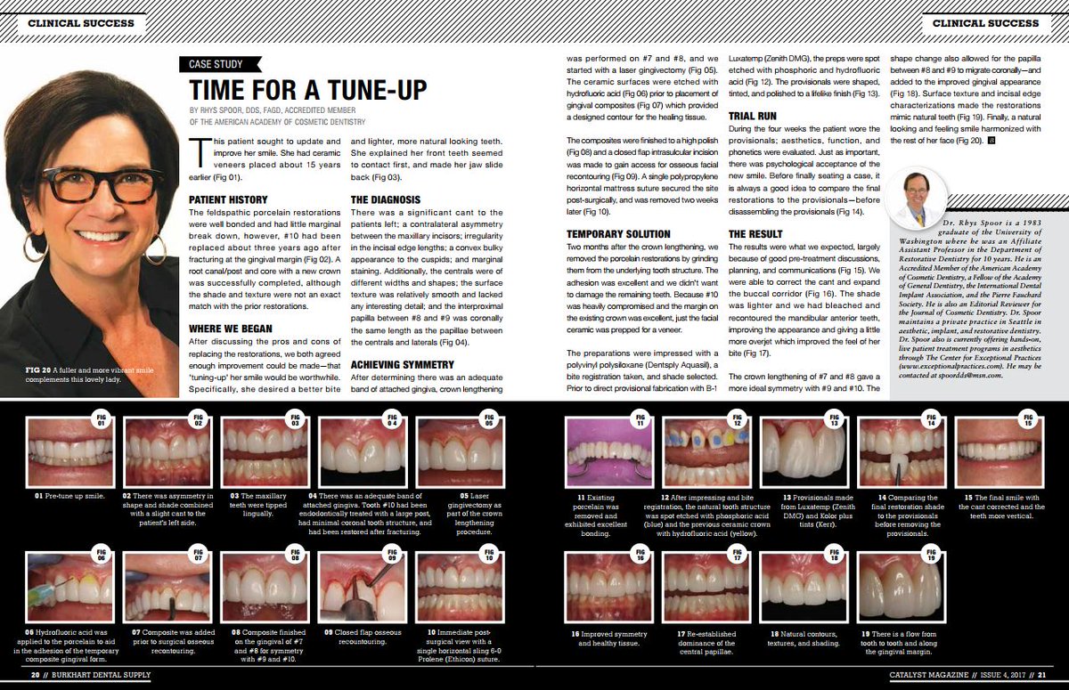 Time for a Tune-Up 
2017 Catalyst - Issue 4
By: Rhys Spoor, DDS, FAGD
owl.li/VvtZ30gl1fB
