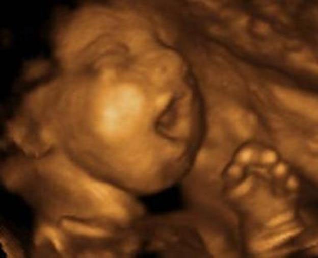 LifeNewsHQ's tweet image. BREAKING: House Passes Tax Plan Recognizing Unborn Children are Human Beings From Conception bit.ly/2jx8phG #ProLife #tcot