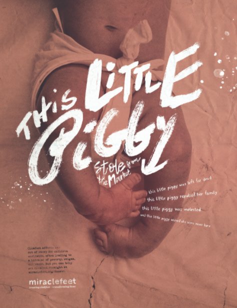 The_Clios's tweet photo. @gswspeakpeople #ClioHealth 2017 Bronze Winner - MiracleFeet: This Little Piggy Campaign by @gswspeakpeople https://t.co/FJRfFuMqWb 🏆 https://t.co/u66sTzKCVV