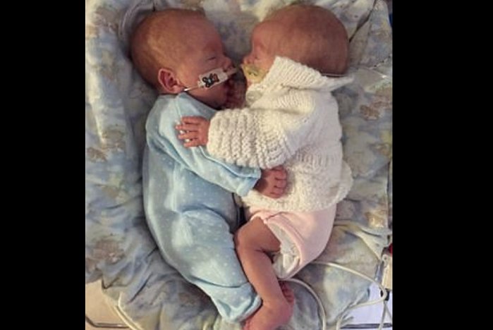 LifeNewsHQ's tweet image. Miraculous Cuddle Helps Twins Survive Who Were Born 13 Weeks Premature bit.ly/2hFqaeu #ThursdayThoughts #ProLife