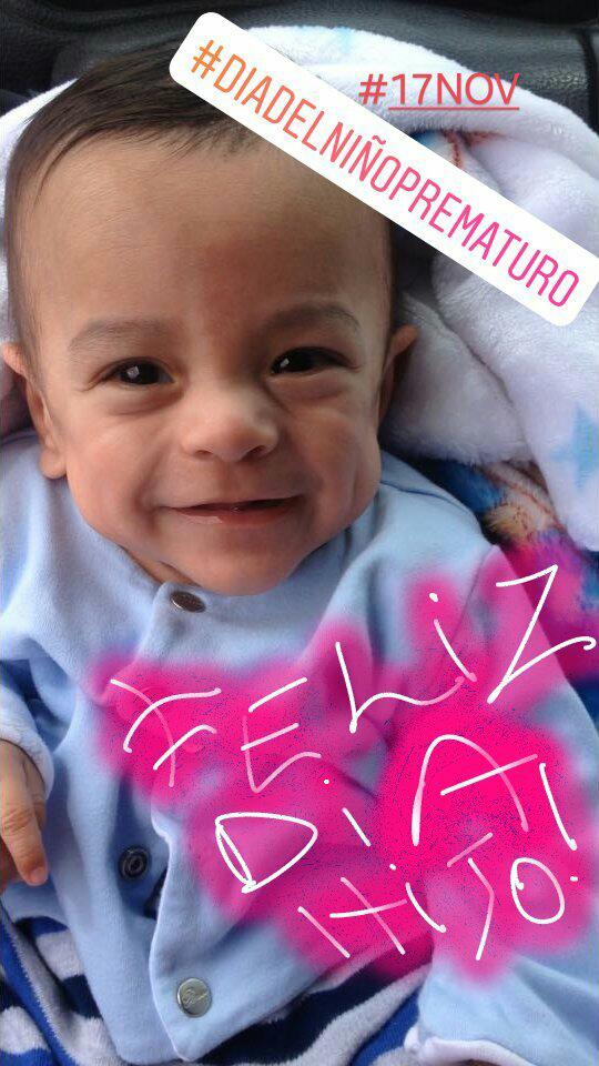 #Hoy  #17Nov   #DIADELNIÑOPREMATURO  HOY MÁS QUENUNCA CELEBRAMOS LA VIDA!!! Benjamín de 24 semanas.605 gramos. <a href="/telefe/">telefe</a> <a href="/telefenoticias/">Telefe Noticias</a> <a href="/HuggiesAr/">Huggies Argentina</a> acompañandonos con los pañales PR. Nos unamos con la causa!!!