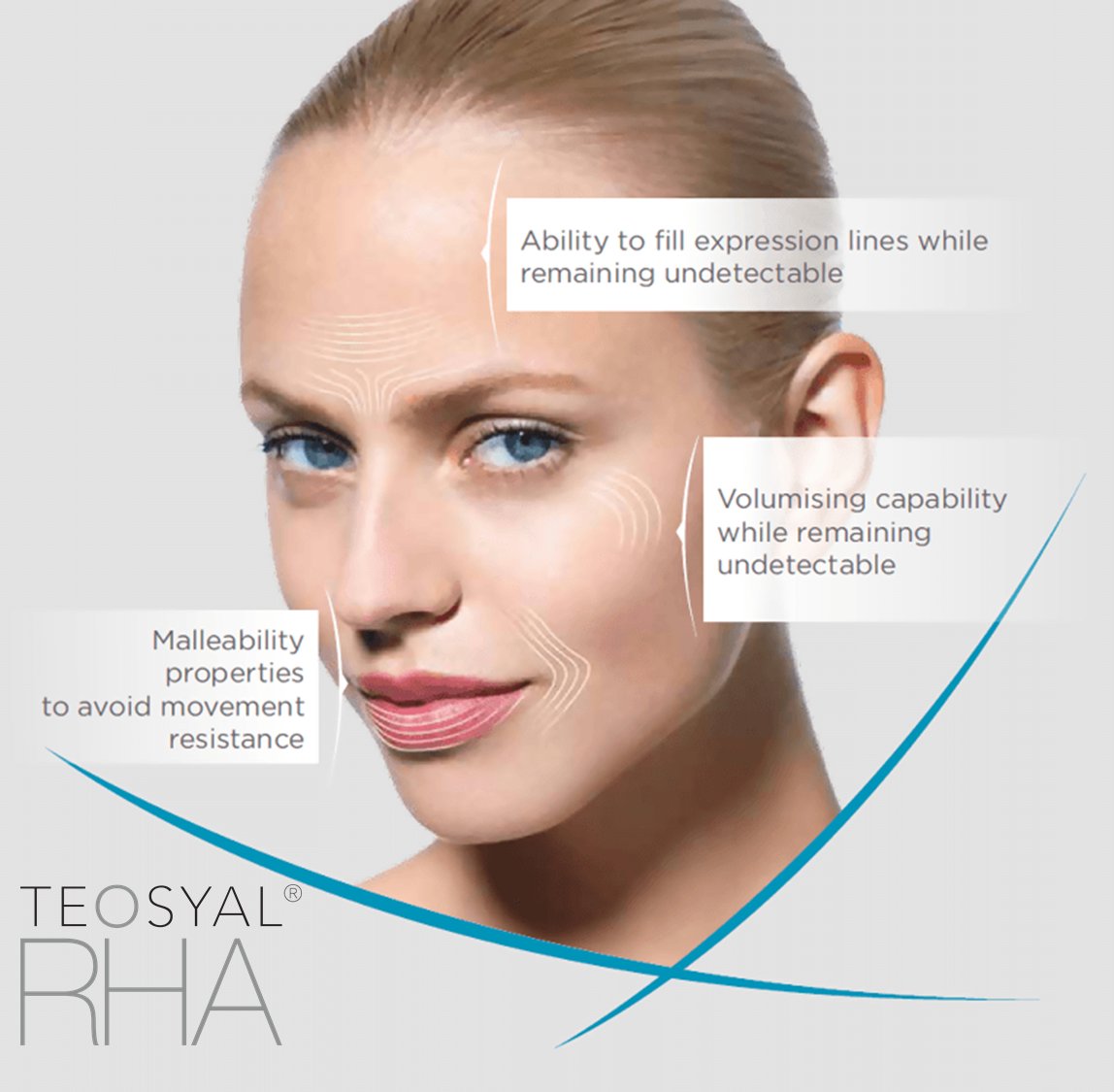 Teosyal RHA for optimal results in each indication. bit.ly/2lGjoWK #teosyalrha #injections #Hyaluronicacid
