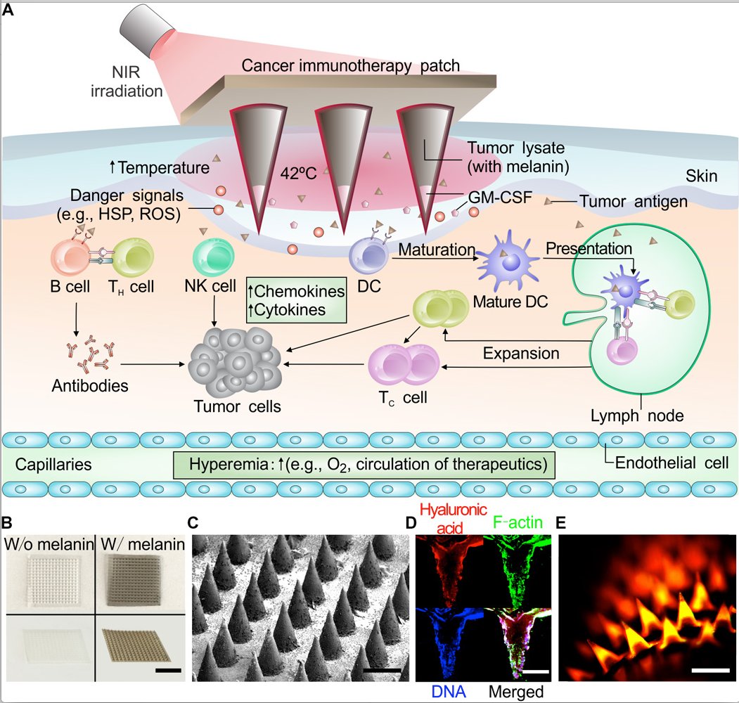 McHeyzer-Williams (@mmw_lmw) on Twitter photo Cancer #ImmunoTherapy | TransDermal #Patch delivery of #TumorAntigens | ZhenGu <a href="/UNC/">UNC-Chapel Hill</a> <a href="/SciImmunology/">Science Immunology</a> buff.ly/2n6dVJT Cancer #ImmunoTherapy | TransDermal #Patch delivery of #TumorAntigens | ZhenGu <a href="/UNC/">UNC-Chapel Hill</a> <a href="/SciImmunology/">Science Immunology</a> buff.ly/2n6dVJT