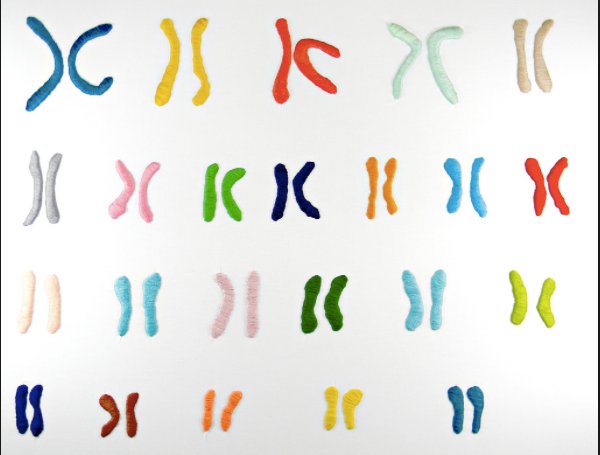 NatureMedicine's tweet photo. Editorial: Genetic association studies of the human genome often omit the X chromosome, but a concerted effort to undo this exclusion could offer medically relevant insights into basic biology that might otherwise be missed: https://t.co/VZbecYUBba https://t.co/xyBGQhOeJQ
