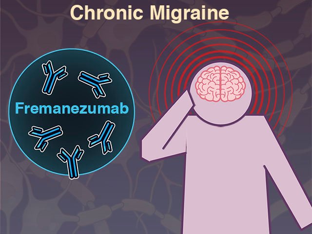 NEJM's tweet photo. New Quick Take video: Preventive Therapy for Chronic #Migraine https://t.co/E1iKmH2flF https://t.co/H0VW13aEvY