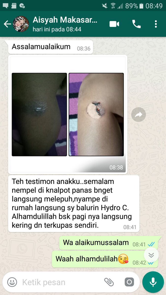 HydroC_Ori's tweet photo. Testi Luka

More info
Indah 
081314409970

#hydroc
#tanpaefeksamping
#multifungsi
#tanpaefeksamping
#tanpaketergantungan
#detoxalami
#mineralajaib
#phdiatas7
#setaradenganzamzam
#1botolberjutamanfaat
#sehatalami
#sehatitumahal
#testiluka https://t.co/D5cyqowwDw