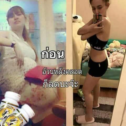 KanokratSikanha's tweet photo. ยาดีรีวิวแน่นขนาดนี้ 👍🏼ราคาแค่หลักร้อย บอกเลยคุ้มมาก‼️ #zoslim
🆔iii_fon
#Howtoperfect #ลดน้ำหนัก https://t.co/6gCkUesZ3q
