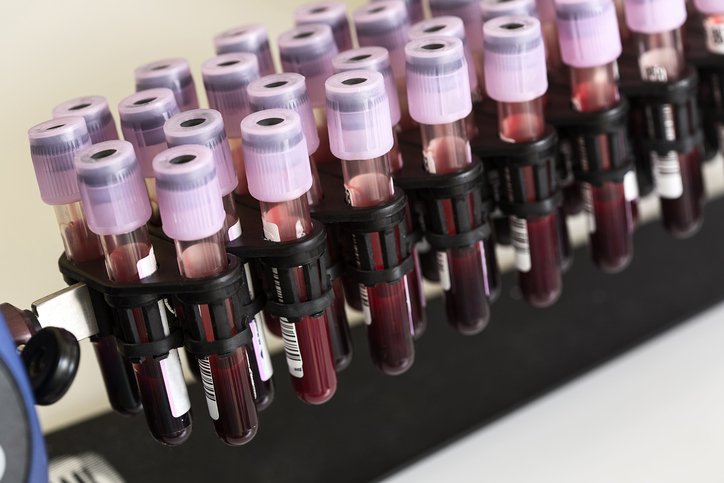 Unnecessary blood cultures risk false positives, #antibiotic overuse and excess costs. Researchers from our #humanfactors center and infectious diseases collaborate to overcome barriers and spread an intervention to reduce inappropriate cultures.
academic.oup.com/jpids/advance-…