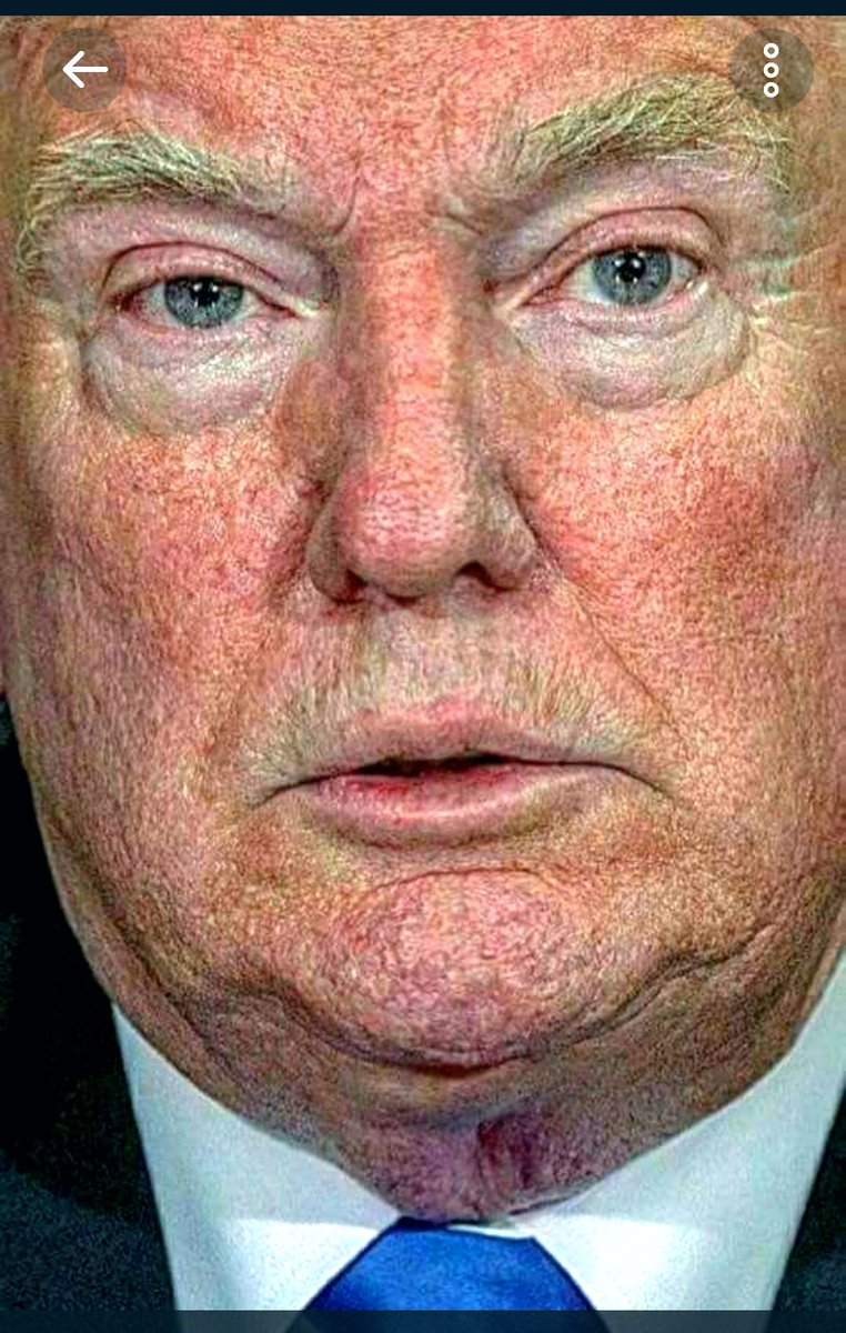 KSD371's tweet image. @realDonaldTrump Please DO NOT 🎀RT @realDonaldTrump goes nuts when he sees this pic @POTUS @FLOTUS 
*wink wink RT tf out of it. DAMN HE'S FUCKING UGLY😂 ‼️This is how mentally disturbing person look #NOTSTABLE