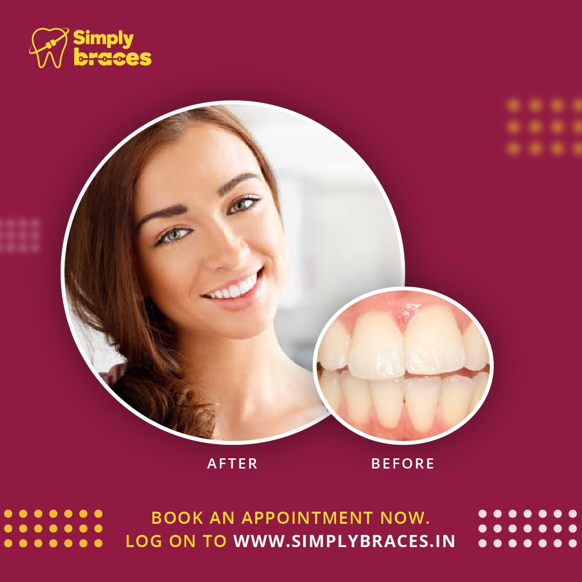 simplybracesIN's tweet photo. Do something today that your future self will thank you for. Book a smile assessment at our center today.
#SBSmiles https://t.co/lsayW9EZZE