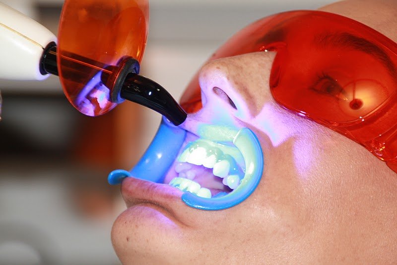 celan's tweet photo. Nuestros tratamientos para blanquear la dentadura no causan debilidad en  la estructura de los dientes ni los afecta. https://t.co/V6yZMv55XG