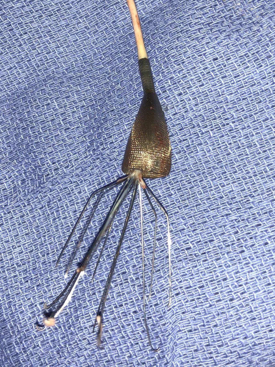 UCD_IR's tweet image. 8 year-old Bard Meridian #filterOUT. Surrendered to Avantec’s Captus device. @rkryu @kush_r_desai @NorthwesternIR #iRad #GTFO