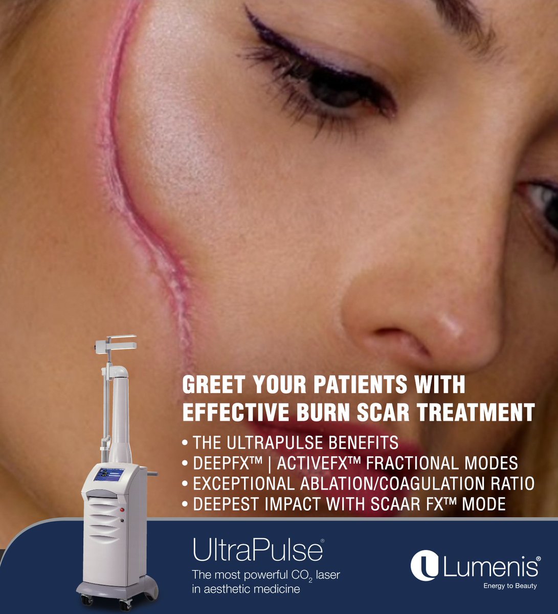 LumenisIndia's tweet photo. UltraPulse can penetrate deeper than any aesthetic ablative CO2 laser. Combined with great versatility, this makes UltraPulse perfect for complex BurnScar procedures.
Visit – https://t.co/MqDbwZfuMP
#Lumenis #UltraPulse #BurnScar https://t.co/CM5C80REKx