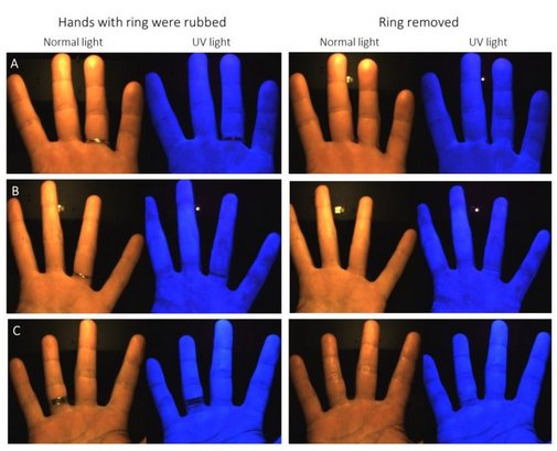 Wearing rings during patient care? How does it affect hand hygiene? Our findings, part 2: bit.ly/2nfOUvA #handhygiene #handinscan