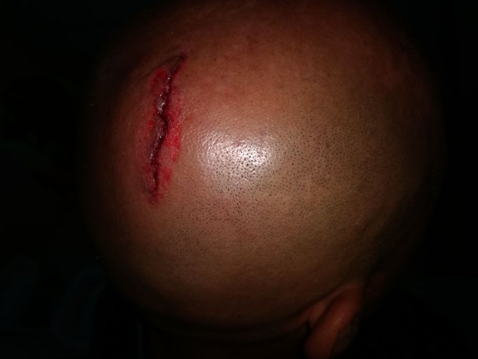 Προβολή εικόνας στο Twitter