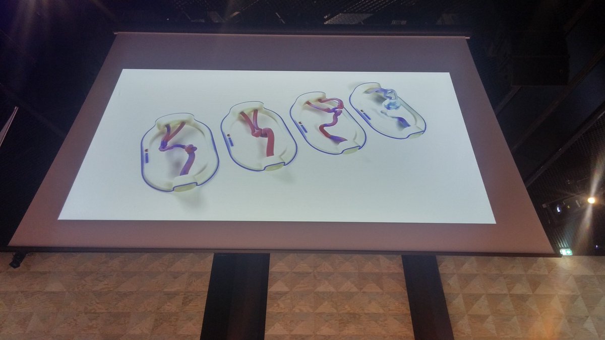 phbaud's tweet photo. .@SidarthRadjou preventing medical errors with #3Dprinting organs and human tissue #surgery #TEDXSaclay @centralesupelec @BIOMODEX https://t.co/OFkMXx9D6v