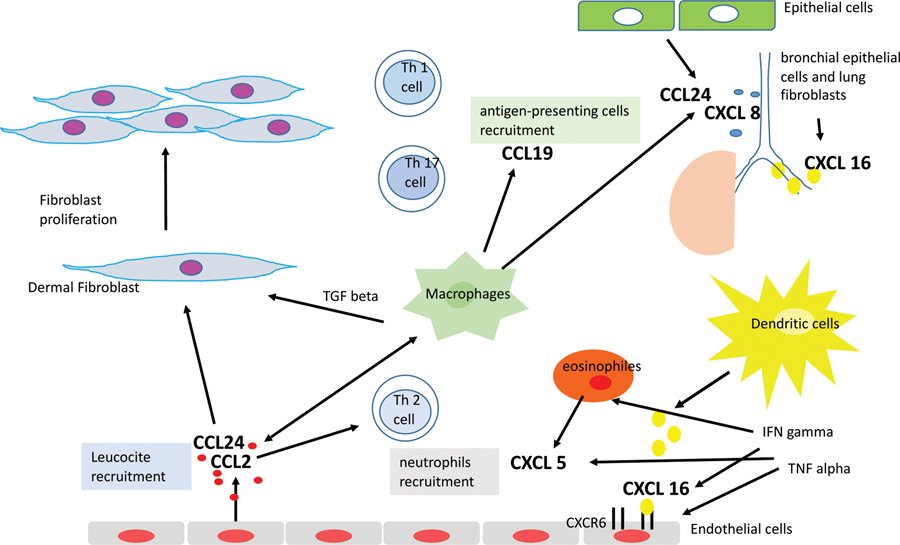 JScleroderma's tweet image. Angiostatic and angiogenic #chemokines in #systemicsclerosis : an overview goo.gl/XV7lh2 #Scleroderma @MatucciMarco @EUSTAR_org