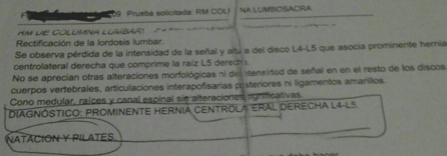 FerranCanes's tweet photo. Esto me he encontrado hoy haciendo la entrevista inicial a una persona...

¿¿Pero que irresponsabilidad es está??

Natación y Pilates como tratamiento a una Hernia CL L4-L5 ??

Por favor, #avancemos, #derivemos, #preguntemos, #consensuemos pero no PERJUDIQUEMOS! 😡🚫 https://t.co/BpiytfnYS2